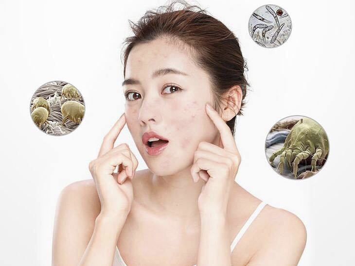 微塵、螨蟲、微生物