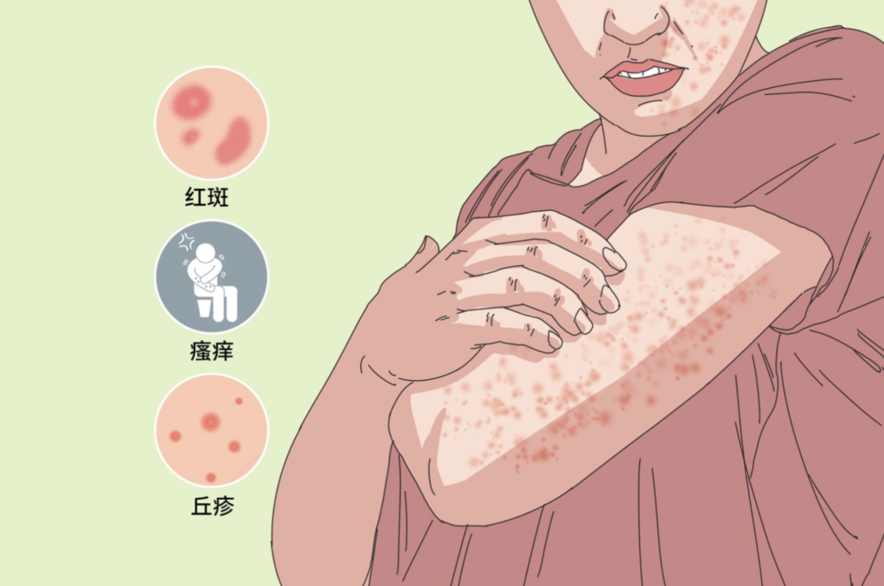皮膚疾病，不僅要治療，更要預(yù)防！